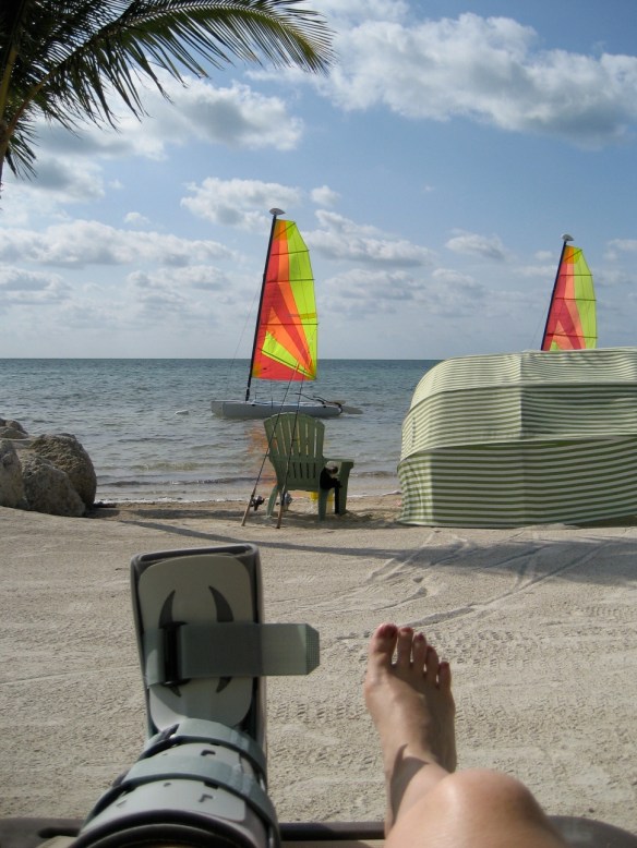 My own sports injury, circa 2007